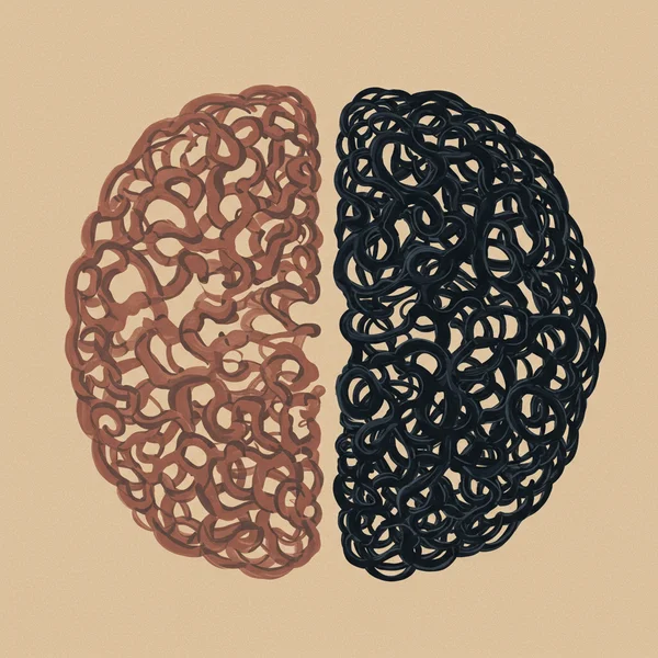 Overlapping brain symptoms, ADHD & anxiety intertwined.